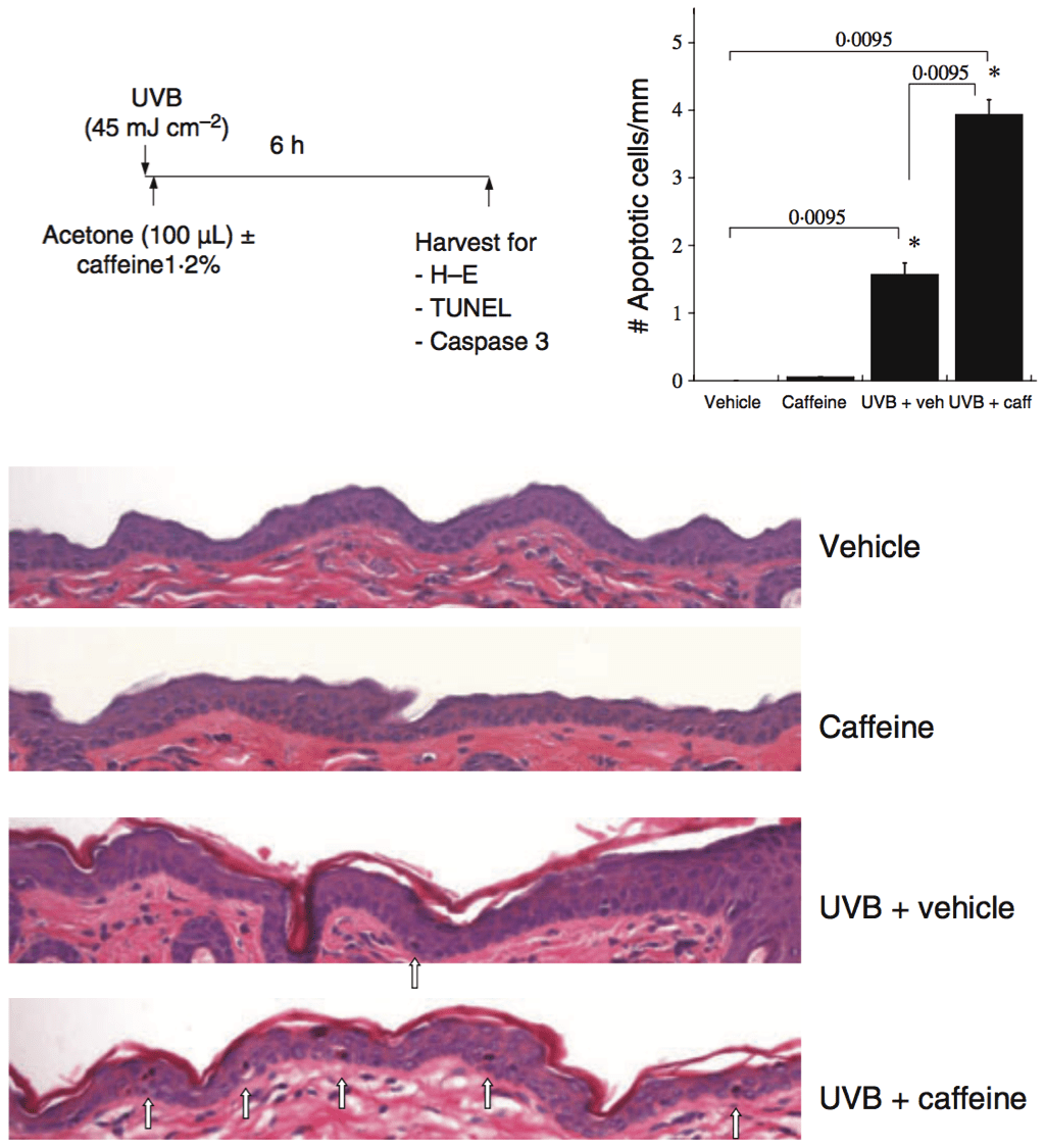 Protection From Photodamage By Topical Application Of Caffeine After Ultraviolet Irradiation