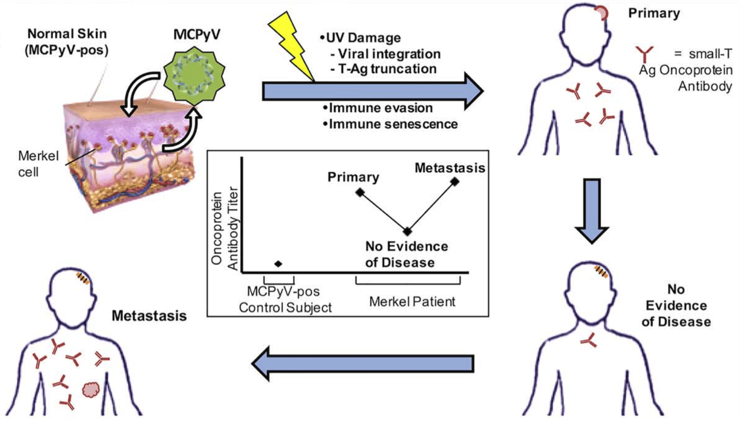 Viral Oncoprotein Antibodies As A Marker For Recurrence Of Merkel Cell Carcinoma: A Prospective Validation Study