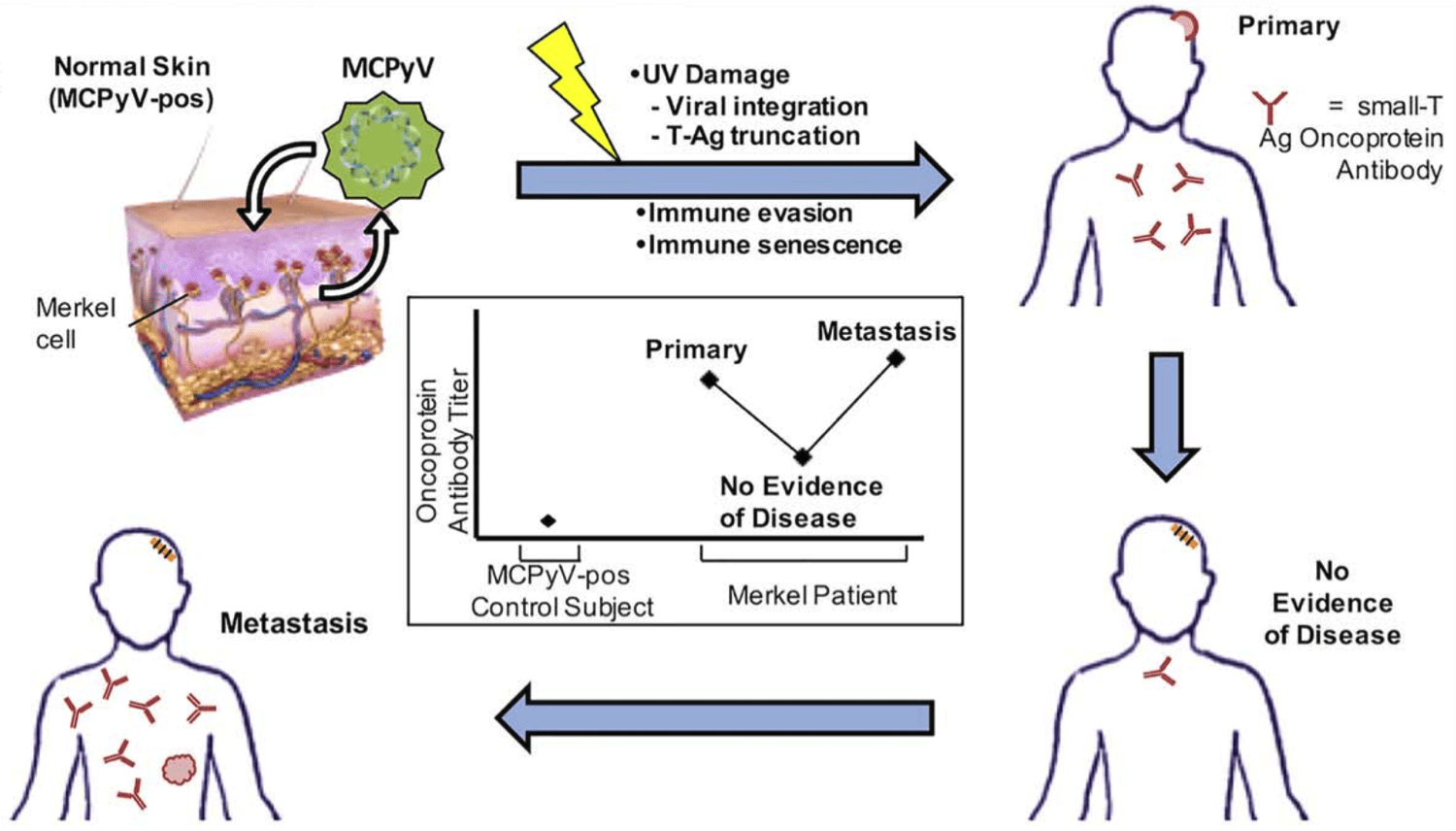 Viral oncoprotein antibodies as a marker for recurrence of Merkel cell carcinoma: a prospective validation study